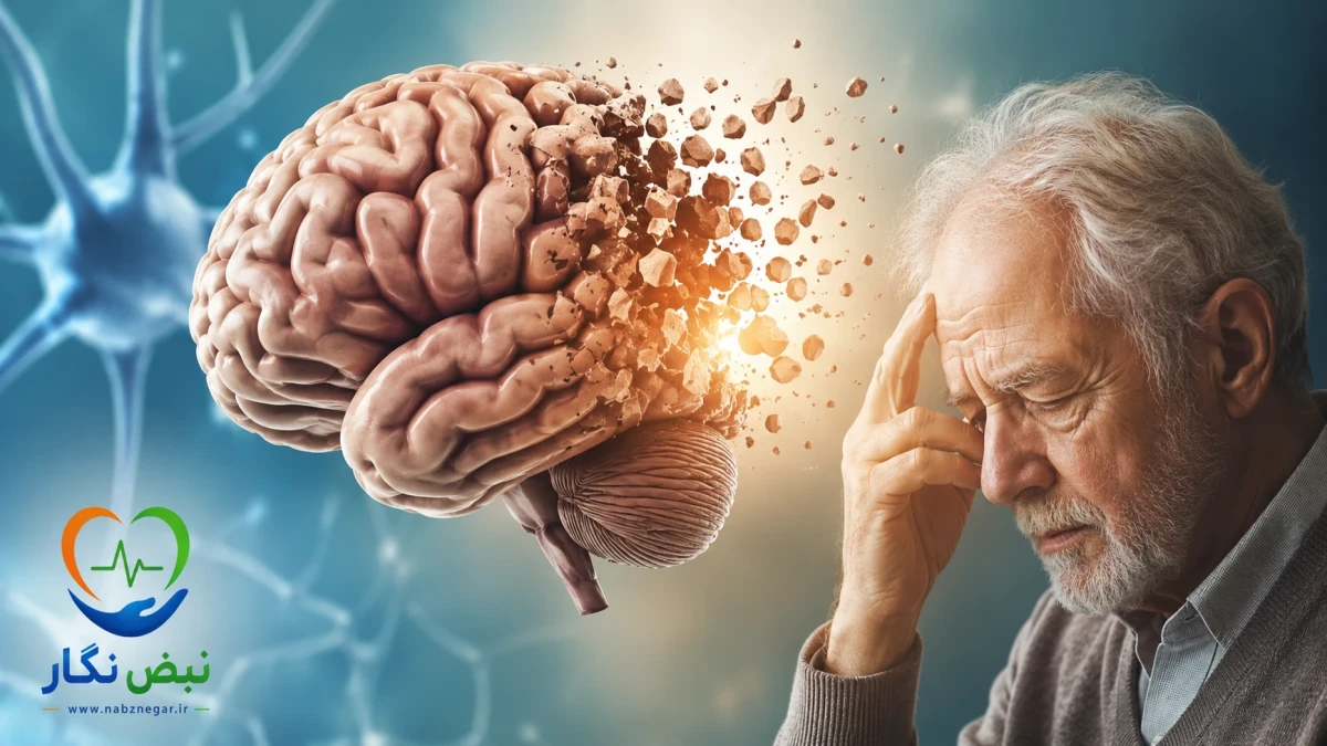 بیماری آلزایمر چیست؟ علائم اولیه، علل، تشخیص، درمان و راه‌های پیشگیری از آلزایمر