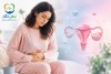 پریود نامنظم چیست؟ علت‌ها، علائم و درمان بی‌نظمی قاعدگی از PCOS تا مشکلات هورمونی