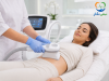 کرایولیپولیز چیست؟ | بررسی علمی فریز چربی، مزایا، عوارض و ماندگاری نتیجه