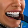روکش دندان چیست؟ انواع، مزایا، عوارض، ماندگاری، هزینه و بهترین انتخاب