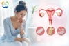 ترشحات واژن؛ رنگ طبیعی و غیرطبیعی، علائم هشدار و زمان مراجعه به پزشک