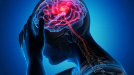 سکته مغزی چیست؟ علائم، علت، درمان و پیشگیری | هر دقیقه تأخیر خطر مرگ را افزایش می‌دهد