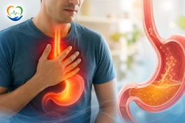 رفلاکس معده (GERD) چیست؟ علائم، علت‌ها و مؤثرترین روش‌های درمان
